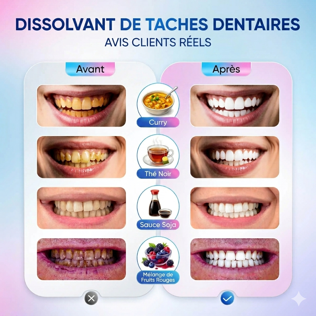 Dentifrice blanchissant à la niacinamide