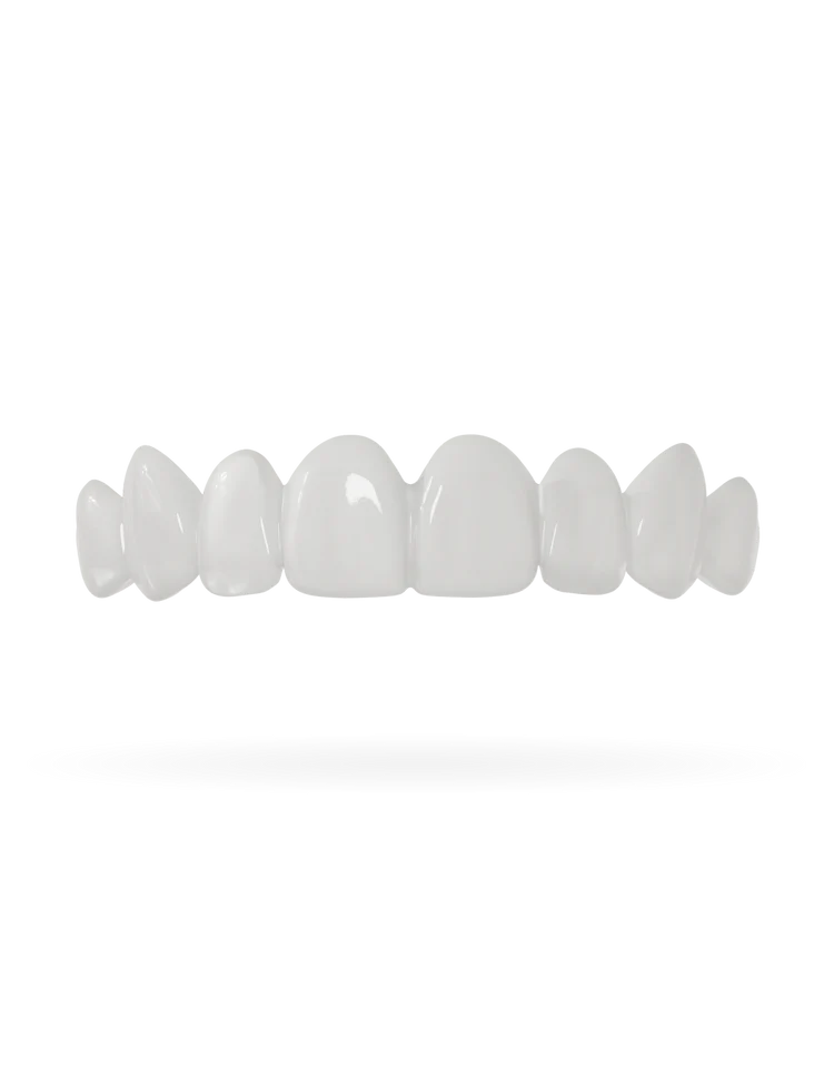 DazzSmile™ Veneers 2.0 - Dazz Smile