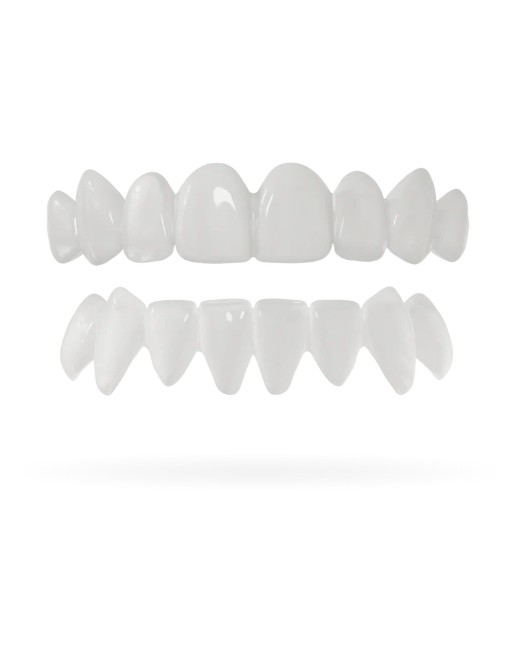 DazzSmile™ Veneers 2.0 - Dazz Smile